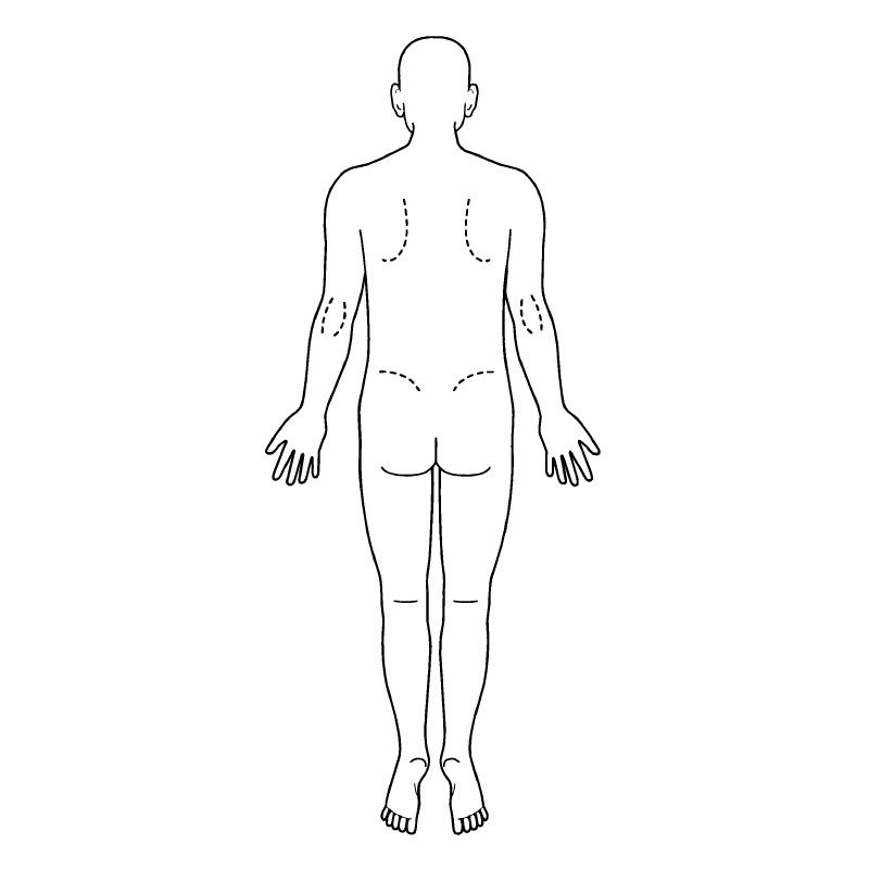 シャチハタ 医療用人体図 全身（男性背面）