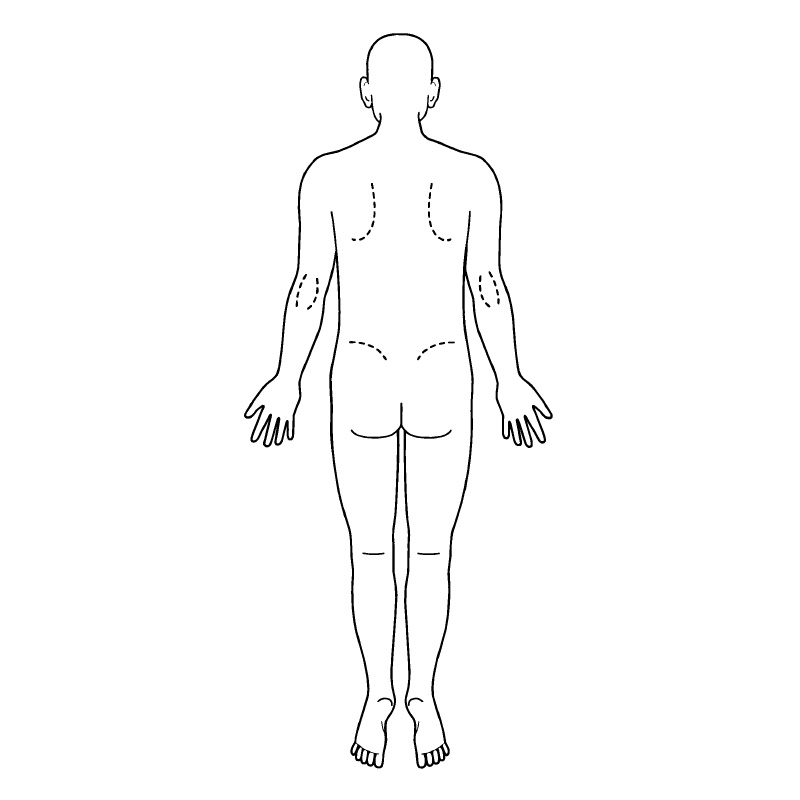 医療用人体図 全身 男性背面 最短即日のシャチハタ館