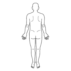 シャチハタ 医療用人体図 全身（男性背面） 