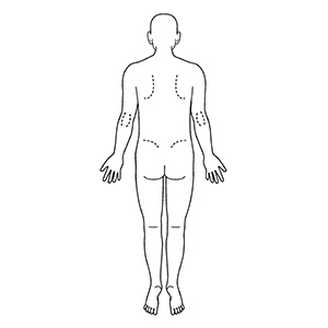 シャチハタ 医療用人体図 全身（男性背面）