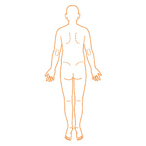 シャチハタ 医療用人体図 全身（背面）