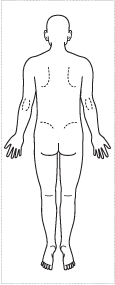 医療用人体図 全身 男性背面 最短即日のシャチハタ館